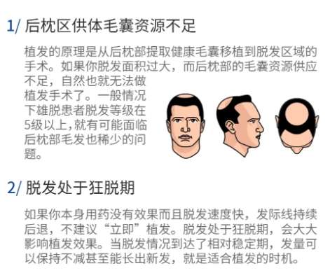 南方医院植发医生排名榜单公布一览！从资质、案例到口碑全解析！