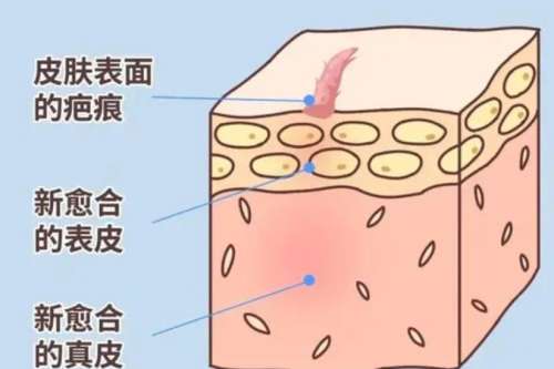 南通大学附属医院整形外科张逸擅长什么？双眼皮、隆鼻等常见项目技术成熟可靠！