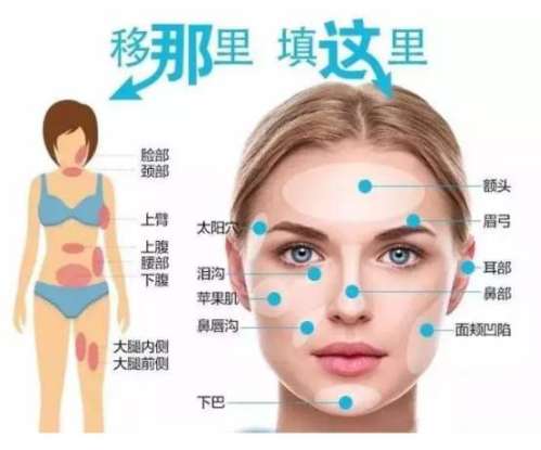 上海脂肪填充脸部好的医生排名2026上新推荐魏皎、汪汇等技术价格全解析