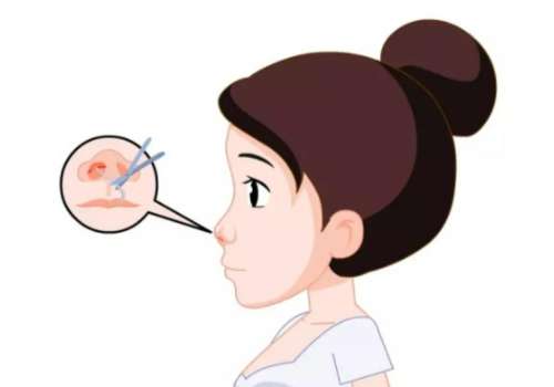 王涛医生隆鼻怎么样？专业资历+技术特色与擅长鼻型风格解析