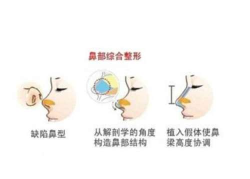 车金昊和于世川鼻综合谁做的好？辽宁曙光扛把子医生，技术价格分析