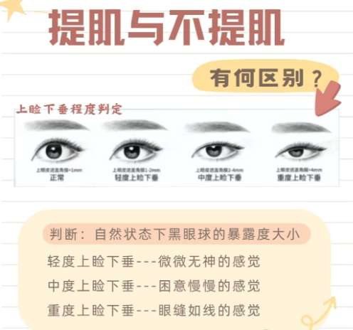 南方医院双眼皮哪个医生好？医生口碑超赞！值得考虑