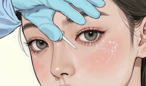 上海华山医院双眼皮丁志，技术水平与术后变化说明