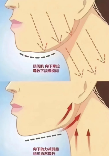 北京八大处磨骨医生名单，轮廓手术医生名单及不同脸型推荐选择