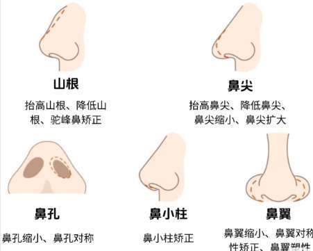 王先成医生隆鼻怎么样？鼻修复|鼻再造|鼻畸形技术强，坐诊湘雅二院