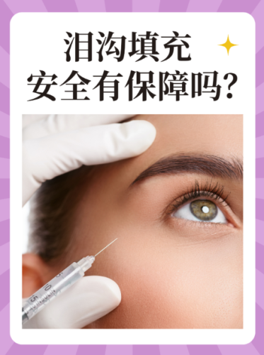 太原泪沟填充好的专家：名医+学术支撑，解锁眼周年轻化密码