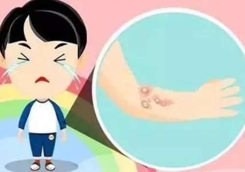 湖南省人民医院雷颖做祛疤怎么样？技术强，案例丰富，详细来袭