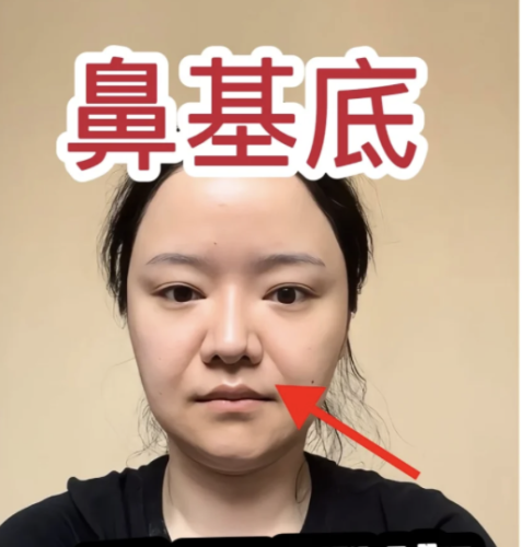 郑州填充鼻基底好的医生是谁？优先盘点：附真实案例+性价比分析