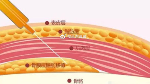 福州填充哪个医生技术好？从技术到案例，一篇搞定“选医生”难题