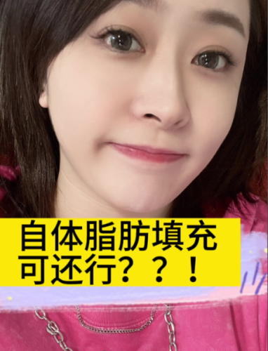 厦门自体脂肪填充好的医生：权威之选+真实案例+避坑指南