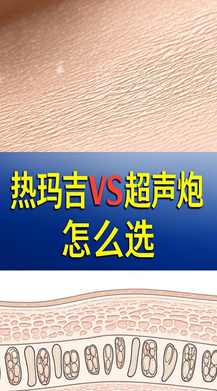 如何选择？