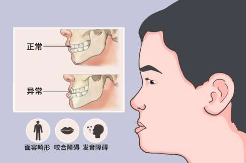 周会喜正颌手术做的怎么样？口碑实力在线，2026费用4万元起