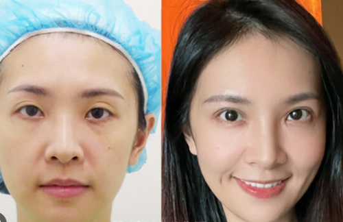 北京同仁医院双眼皮手术谁做的好？马涛、许莲姬、王爽都有上榜