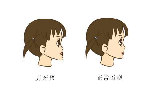 八大处杨斌主任做正颌怎么样？技术审美在线，附最新价格2026