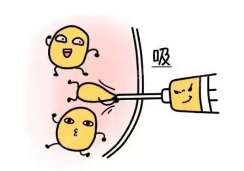 董自清吸脂怎么样？准备做吸脂的姐妹一定要码住