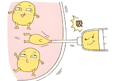 北京脂肪填充王自谦怎么样？技术亮点与价格参考