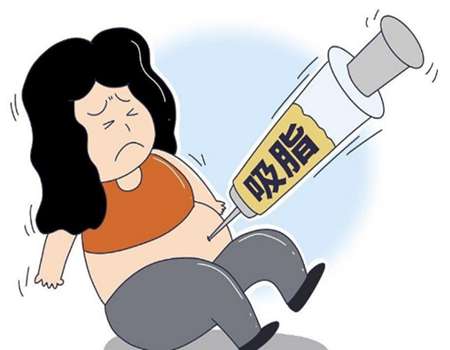 南京吸脂医生哪个比较好？技术靠谱的医生在线看