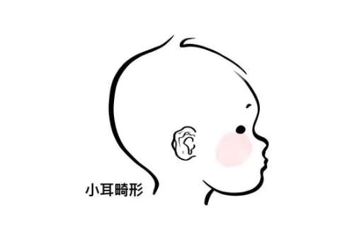 蒋海越耳再造排名第几？位居榜前！经验丰富|实力在线！