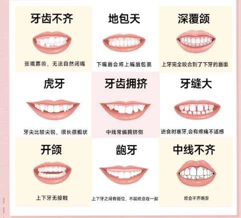 沈阳地包天手术整形费用多少？价格表更新！