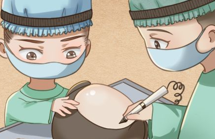 成都植发多少钱一个单位？价格表扒的明明白白！
