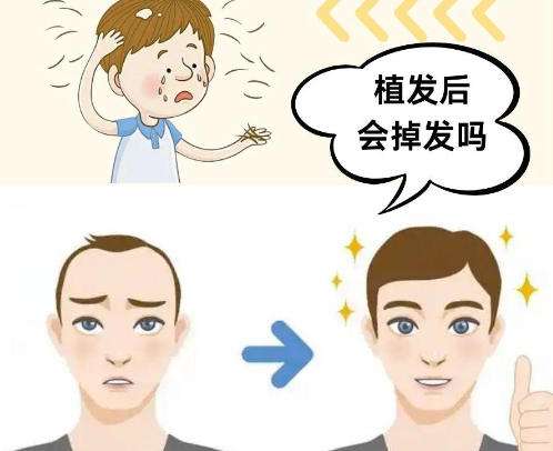 北京大学首钢医院雷鸣医生植发口碑怎么样？植发案例图展示！