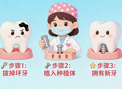 镇江口腔医院种牙多少钱？公立院各品牌收费都问清楚了，种牙前看一眼