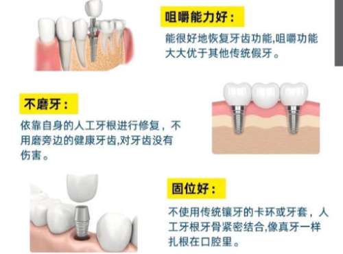 临汾种一颗牙多少钱？价格在3k到1w不等含三家优质医院推荐！