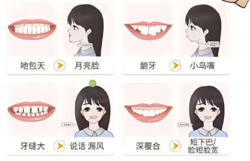 泰州牙齿矫正多少钱？2026收费价目表更新！龅牙矫正低至1w左右