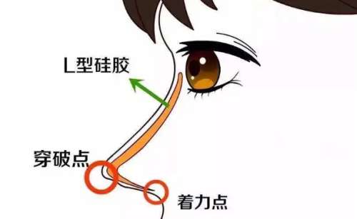 盐城长鼻矫正哪个医生能做|前八名医生介绍
