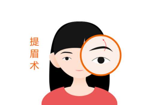 上海国际医院提眉价格多少？5000元起，医生资源丰富，详情解析来袭