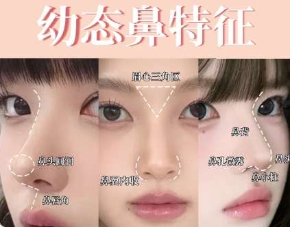 郑州隆鼻多少费用贵吗？大概7800元左右起？各医院有所区别