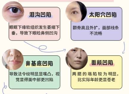 上海中山医院玻尿酸填充鼻基底价格贵不贵？人气医生名单附上