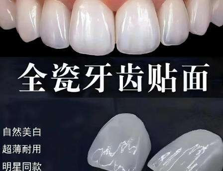 济南全瓷贴面大概多少钱？当地性价比医院推荐！
