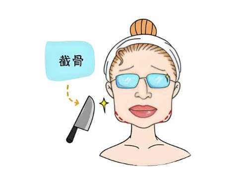 厦门整形科磨骨多少钱一次？低至3万元！附价格表