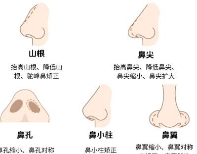 滨州隆鼻假体整形价格贵不贵？推荐几家口碑好又实惠的机构！