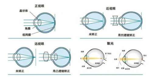 湖州公立医院全飞秒激光多少钱？15800-23800元不等，含医院测评！