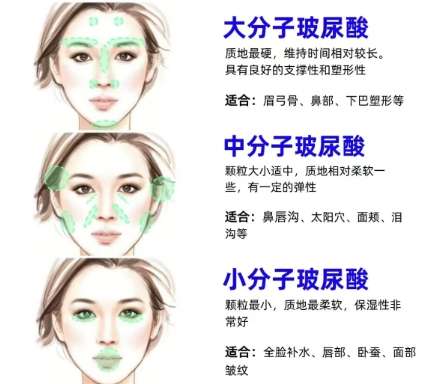 海口打美骨针多少钱？推荐几家口碑好又实惠的机构！