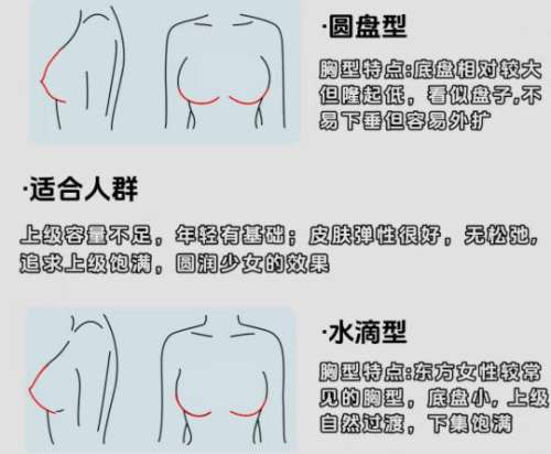 北京协和医院王智的手术案例怎么样？隆胸技术靠谱吗？案例展示