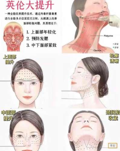九院梁奕敏做英伦提升大概多少钱？填充玻尿酸3000元-8000元起步！
