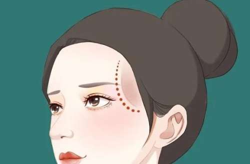 武汉填充太阳凹脸颊大概多少钱？大致在18,718~49,774元左右！