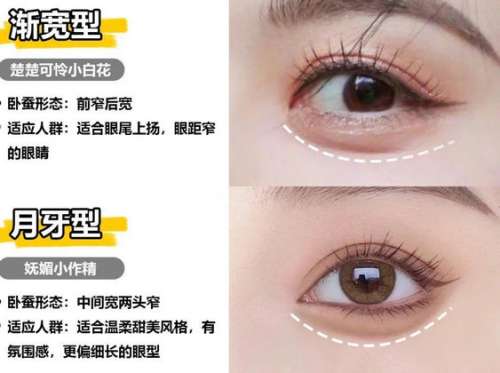 杨明勇做真皮卧蚕再造吗？信息介绍盘点！案例点评