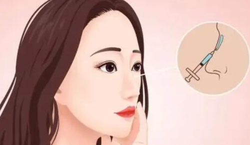 上海九医院玻尿酸隆鼻价格，不同品牌、不同剂量收费差异一文讲透