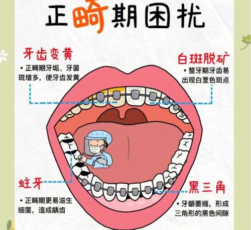 无锡市口腔医院正畸价格表参考！推荐几家性价比不错的医院