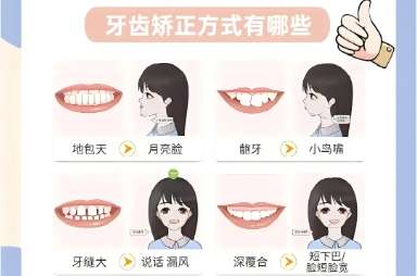 南京市口腔矫正牙齿多少钱？价格表详细情况参考！