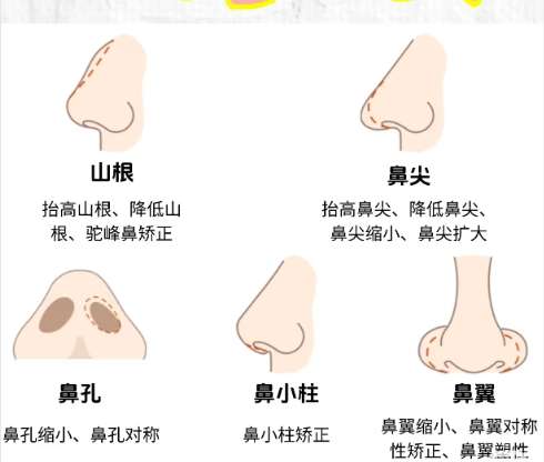 上海第二人民医院隆鼻价格贵不贵？隆鼻 2w+、双眼皮8k起