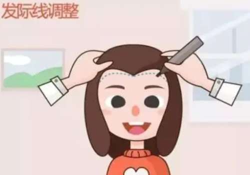 深圳华侨医院植发多少钱？发际线6k元起，2026年顾客反馈成效好