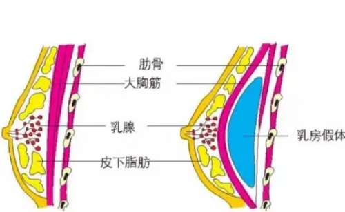 北京丽都胡斌医生资料及介绍！技术娴熟口碑好