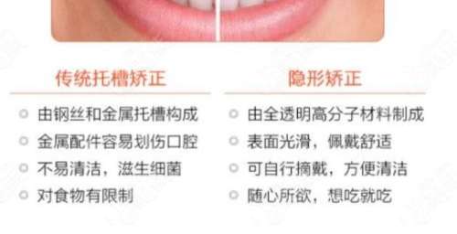 宜宾喜牙口腔正畸价格8000元到4万元不等，不同年龄矫正方案分析