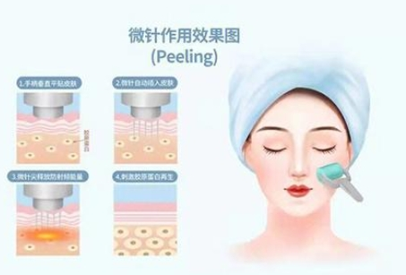 北京八大处黄金微针价格，算一算在八大处做黄金微针要花多少
