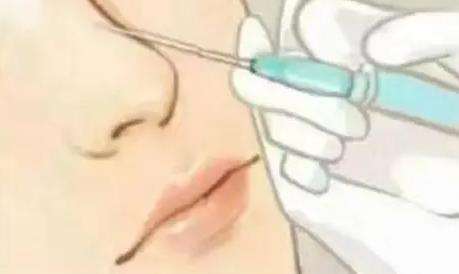 大连注射隆鼻多少钱？当地性价比机构推荐！